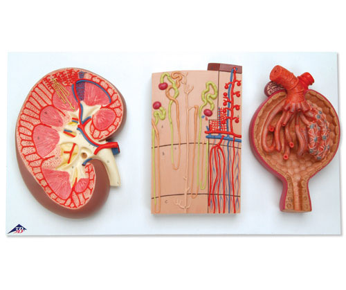 IIλѪܺIСwģ